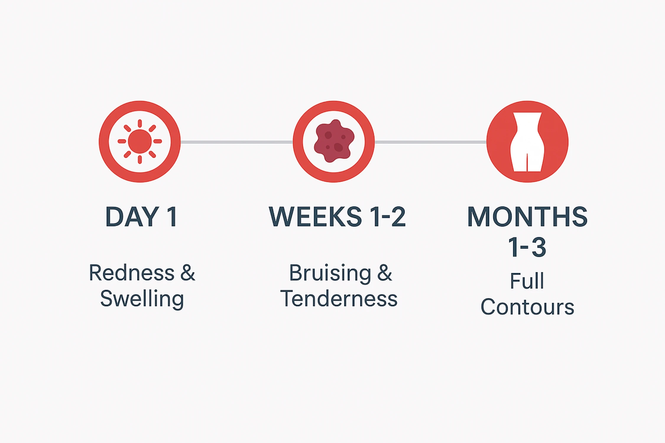 Horizontal timeline with icons for Day 1 redness, Weeks 1–2 bruising, Months 1–3 contour results after cryolipolysis