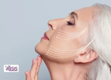 how long does facial rejuvenation last