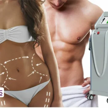 Is cryolipolysis worth it
