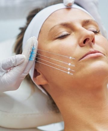 The Future of Facelifts: Non-Invasive Solutions Taking Center Stage in 2024