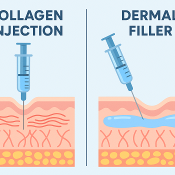 Collagen injections vs. dermal fillers – facial rejuvenation comparison